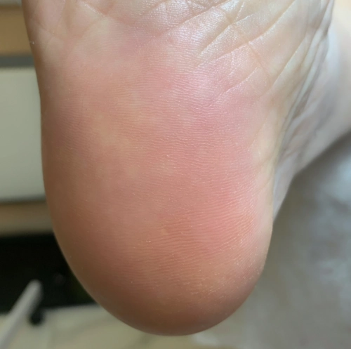 Центр подологии "Про Стопы".