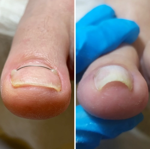 Центр подологии "Про Стопы".