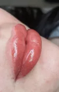 Миниатюра 8