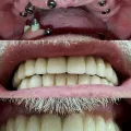 Миниатюра 8