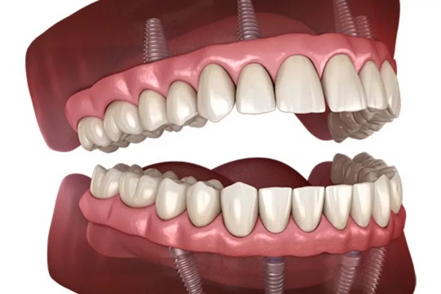 Стоматология Micris Dental Clinic в Дубаи: Стоматология , Стоматолог 🦷 , ОАЭ 🇦🇪 , Медицина , Лечение кариеса, Врач, Доктор , Следить за здоровьем,