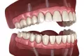 Миниатюра 6