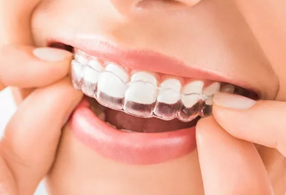 Стоматологическая клиника «Ilham Dental Clinic»