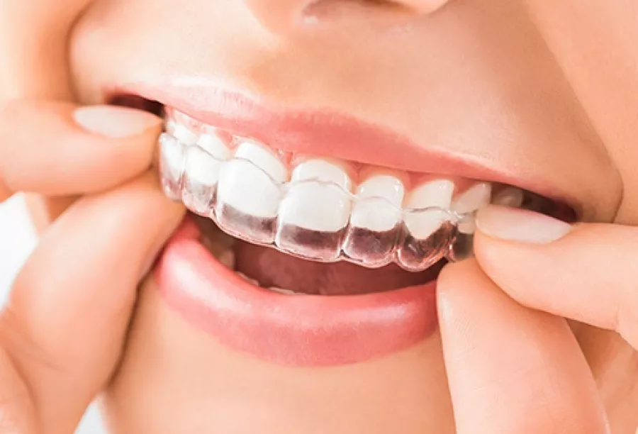 Стоматологическая клиника Ilham Dental Clinic в Дубаи: Стоматолог 🦷 , Стоматология , Медицина , Лечение зубов , Лечение кариеса , Зубы , Следить за здоровьем,
