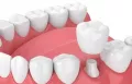 Миниатюра 8