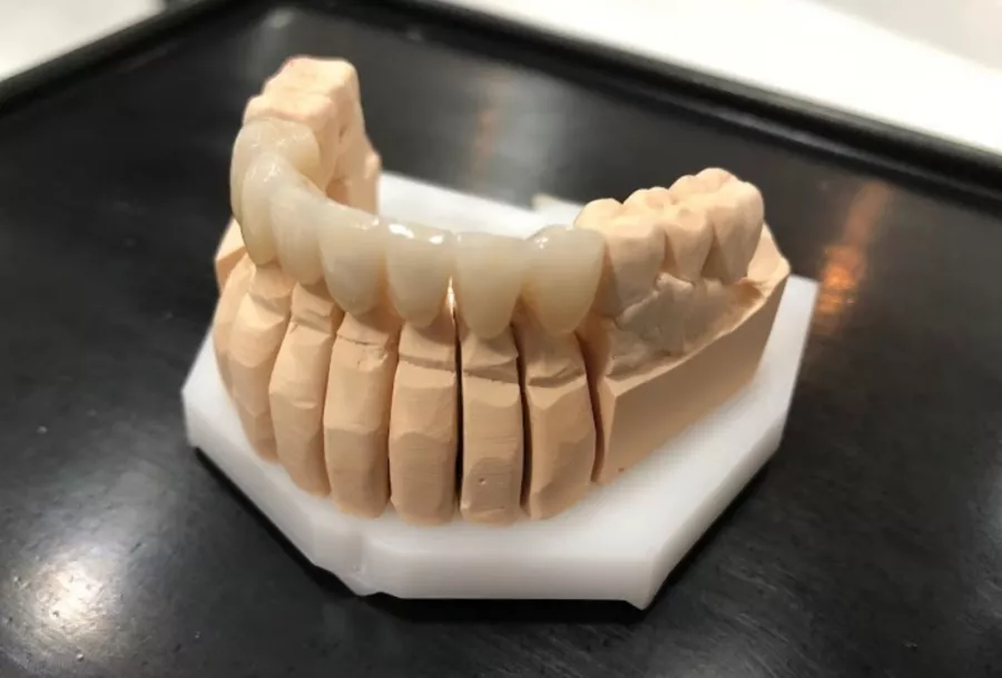 Стоматология Versailles Dental Clinic в Дубаи: Лечение Зуба, Доктор, Стоматолог, Здоровье,