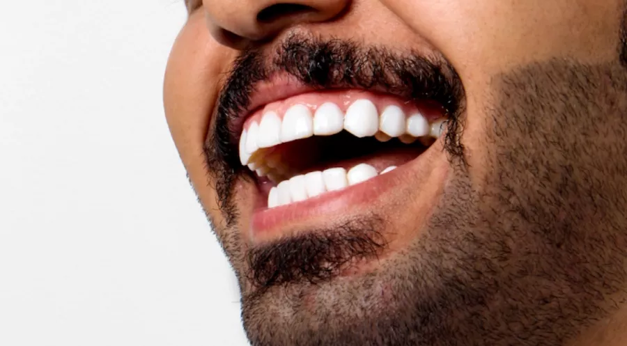 Стоматология GYA dental center в Дубаи: Лечение Зуба, Зубы, Здоровье, Стоматолог,