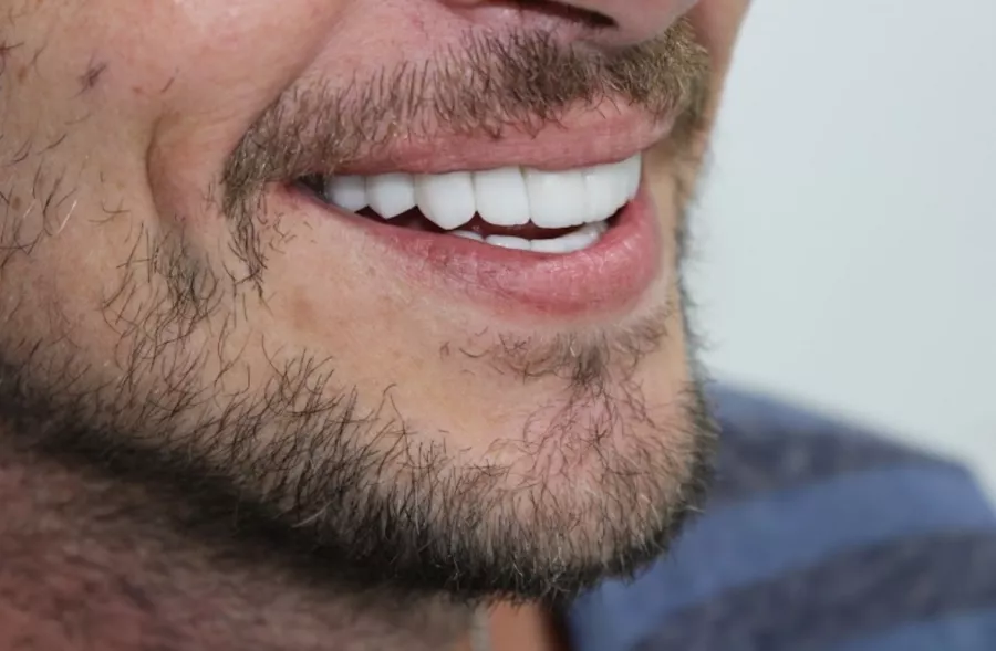 Стоматология GYA dental center в Дубаи: Лечение Зуба, Зубы, Здоровье, Стоматолог,