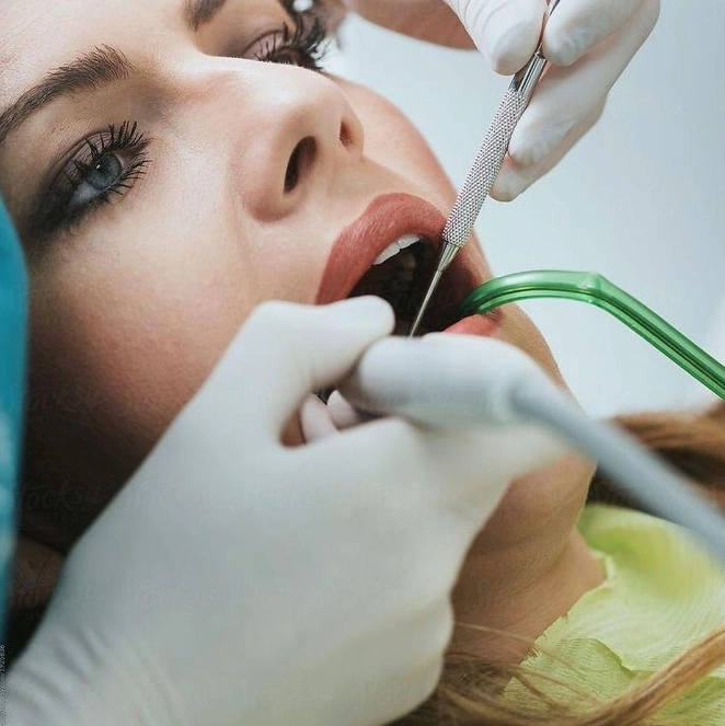 Стоматологическая клиника GDENT&Cosmetology в Новосибирске: Удаление зубов, Лечение зубов, Лечение десен, Пломбирование, Отбеливание,