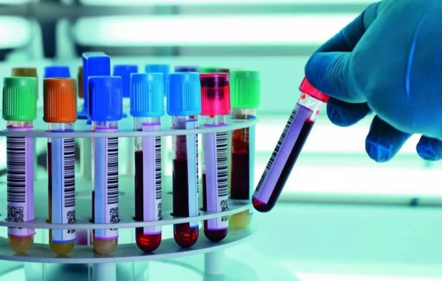 Лаборатория Nabon в Пхукете: Лаборатория, Laboratory, Blood, Clinic, Кровь, Клиника, Доктор, Doctor,