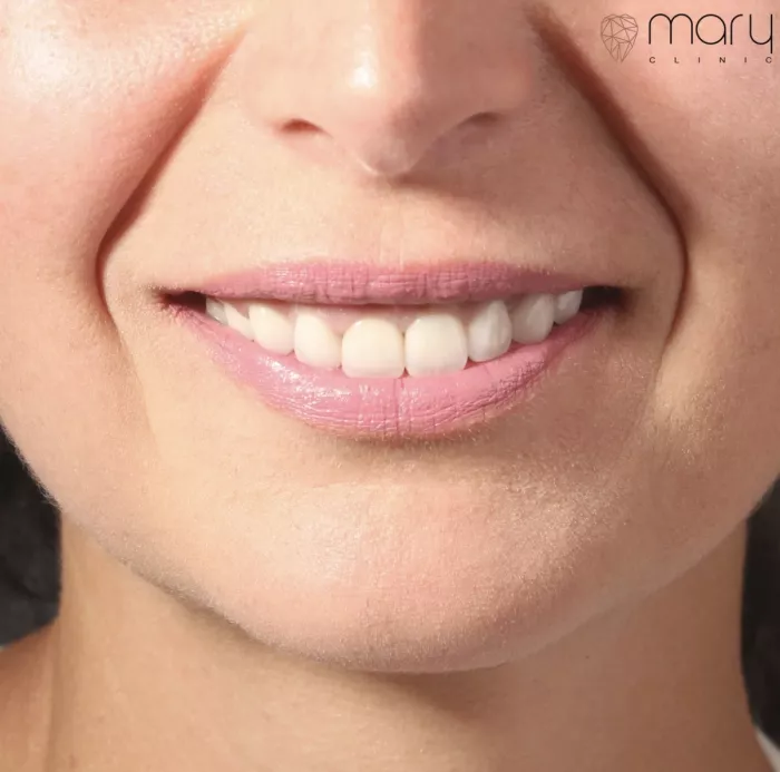 Стоматологическая клиника в Ереване, Армения